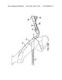 ARTICULATING SUTURING DEVICE AND METHOD diagram and image