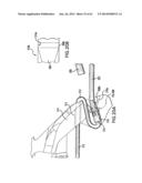 ARTICULATING SUTURING DEVICE AND METHOD diagram and image