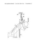 ARTICULATING SUTURING DEVICE AND METHOD diagram and image