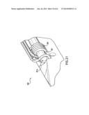 ARTICULATING SUTURING DEVICE AND METHOD diagram and image