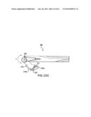 ARTICULATING SUTURING DEVICE AND METHOD diagram and image