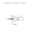 ARTICULATING SUTURING DEVICE AND METHOD diagram and image