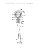 ARTICULATING SUTURING DEVICE AND METHOD diagram and image