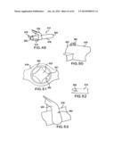 ARTICULATING SUTURING DEVICE AND METHOD diagram and image