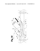 VASCULAR ANASTOMOSIS DEVICE AND METHOD diagram and image