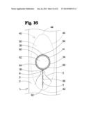 VASCULAR ANASTOMOSIS DEVICE AND METHOD diagram and image