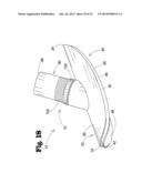 VASCULAR ANASTOMOSIS DEVICE AND METHOD diagram and image