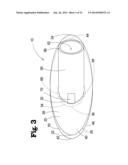 VASCULAR ANASTOMOSIS DEVICE AND METHOD diagram and image