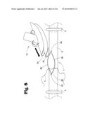 VASCULAR ANASTOMOSIS DEVICE AND METHOD diagram and image