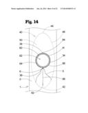 VASCULAR ANASTOMOSIS DEVICE AND METHOD diagram and image