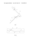 IMAGING AND REMOVING BIOLOGICAL MATERIAL diagram and image