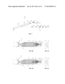 IMAGING AND REMOVING BIOLOGICAL MATERIAL diagram and image