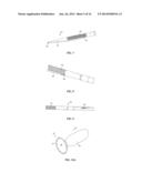 IMAGING AND REMOVING BIOLOGICAL MATERIAL diagram and image