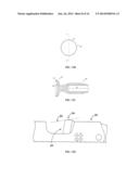 IMAGING AND REMOVING BIOLOGICAL MATERIAL diagram and image