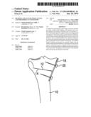 METHODS AND SYSTEMS FOR PLANNING AND PERFORMING AN OSTEOTOMY diagram and image