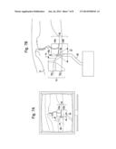 METHODS AND SYSTEMS FOR PLANNING AND PERFORMING AN OSTEOTOMY diagram and image