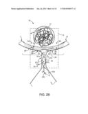 ANEURYSM OCCLUSION SYSTEM AND METHOD diagram and image