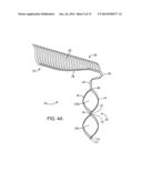 ANEURYSM OCCLUSION SYSTEM AND METHOD diagram and image