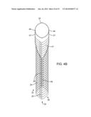 ANEURYSM OCCLUSION SYSTEM AND METHOD diagram and image