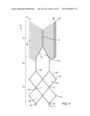 ANEURYSM OCCLUSION SYSTEM AND METHOD diagram and image