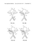 ANEURYSM OCCLUSION SYSTEM AND METHOD diagram and image