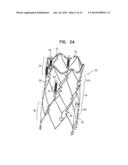 WIRELESS ENDOVASCULAR STENT-BASED ELECTRODES diagram and image