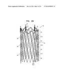 WIRELESS ENDOVASCULAR STENT-BASED ELECTRODES diagram and image