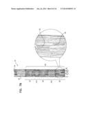 WIRELESS ENDOVASCULAR STENT-BASED ELECTRODES diagram and image