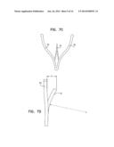 WIRELESS ENDOVASCULAR STENT-BASED ELECTRODES diagram and image