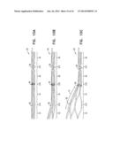 WIRELESS ENDOVASCULAR STENT-BASED ELECTRODES diagram and image