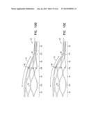 WIRELESS ENDOVASCULAR STENT-BASED ELECTRODES diagram and image