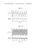 WIRELESS ENDOVASCULAR STENT-BASED ELECTRODES diagram and image