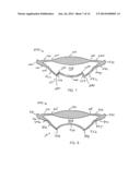 ACCOMMODATING INTRAOCULAR LENS diagram and image