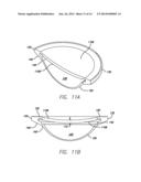 ACCOMMODATING INTRAOCULAR LENS diagram and image