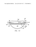 ACCOMMODATING INTRAOCULAR LENS diagram and image