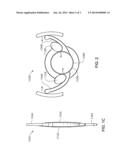 CURVATURE CHANGING ACCOMMODATIVE INTRAOCULAR LENS diagram and image