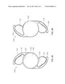 CURVATURE CHANGING ACCOMMODATIVE INTRAOCULAR LENS diagram and image