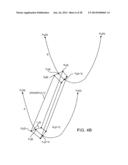 COMPUTER AUTOMATED DEVELOPMENT OF AN ORTHODONTIC TREATMENT PLAN AND     APPLIANCE diagram and image