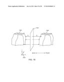 COMPUTER AUTOMATED DEVELOPMENT OF AN ORTHODONTIC TREATMENT PLAN AND     APPLIANCE diagram and image