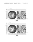 Gesture-Based Interface for a Multi-Modality Medical Imaging System diagram and image