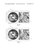 Gesture-Based Interface for a Multi-Modality Medical Imaging System diagram and image