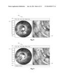 Measurement Navigation in a Multi-Modality Medical Imaging System diagram and image