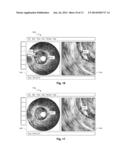 Measurement Navigation in a Multi-Modality Medical Imaging System diagram and image