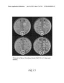 Isolated eIF-5A and Polynucleotides Encoding Same diagram and image