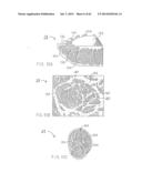 REMOVABLE ROUNDED MIDSOLE STRUCTURES AND CHAMBERS WITH COMPUTER     PROCESSOR-CONTROLLED VARIABLE PRESSURE diagram and image