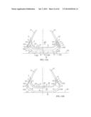 REMOVABLE ROUNDED MIDSOLE STRUCTURES AND CHAMBERS WITH COMPUTER     PROCESSOR-CONTROLLED VARIABLE PRESSURE diagram and image