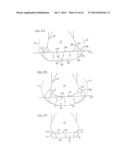 REMOVABLE ROUNDED MIDSOLE STRUCTURES AND CHAMBERS WITH COMPUTER     PROCESSOR-CONTROLLED VARIABLE PRESSURE diagram and image