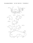 REMOVABLE ROUNDED MIDSOLE STRUCTURES AND CHAMBERS WITH COMPUTER     PROCESSOR-CONTROLLED VARIABLE PRESSURE diagram and image