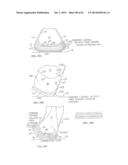 REMOVABLE ROUNDED MIDSOLE STRUCTURES AND CHAMBERS WITH COMPUTER     PROCESSOR-CONTROLLED VARIABLE PRESSURE diagram and image