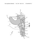 DUAL LOCK RING WHEEL ASSEMBLY diagram and image